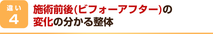 施術前後(ビフォーアフター)の変化の分かる整体
